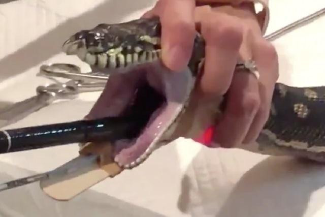 Các bác sĩ chuẩn bị kéo chiếc khăn tắm khỏi bụng trăn