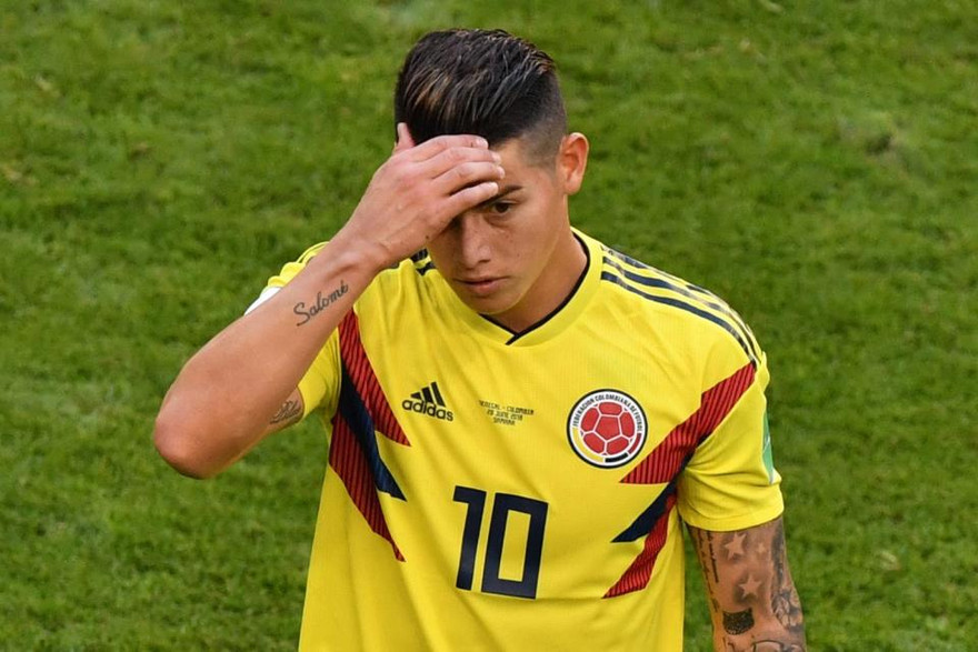 James Rodriguez dính chấn thương trước Senegal.