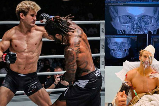 Sage Northcutt phải nhập viện vì bị đối thủ đấm rạn xương mặt.