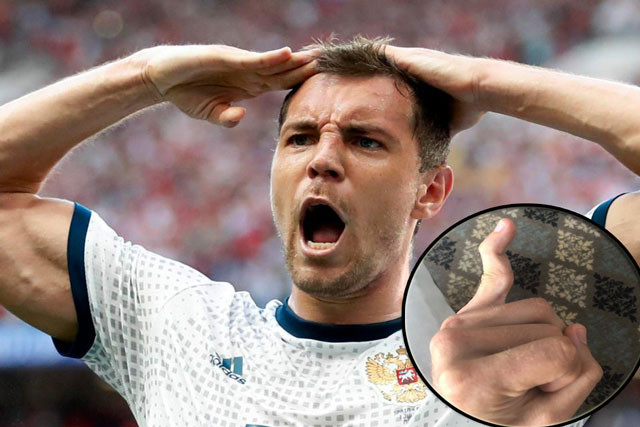 Đấu Croatia, ngôi sao tuyển Nga khoe chấn thương 'kỳ dị'