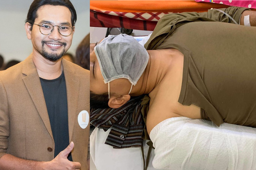 Diễn viên Huỳnh Đông bị tai nạn ngã gãy tay khi quay phim