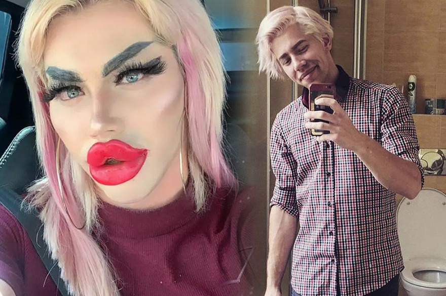 Chàng trai chật vật tìm bạn gái, chi 450 triệu đồng phẫu thuật giống búp bê Barbie