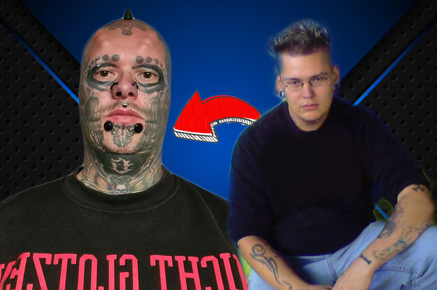 Kinh hãi trước gương mặt của ‘dị nhân’ Đức không tai, phẫu thuật 17 lần cho giống đầu lâu