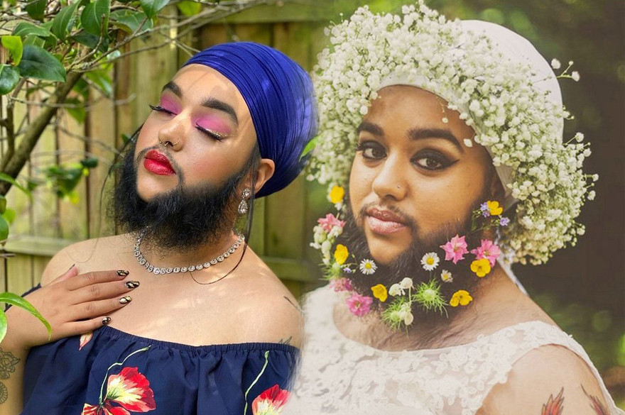 Nữ người mẫu có râu tự tin về vẻ ngoài gợi cảm dù khác biệt