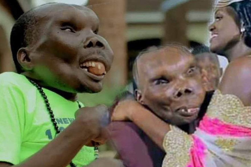 Bất ngờ với hình ảnh đám cưới lần ba của ‘người đàn ông xấu xí nhất thế giới’