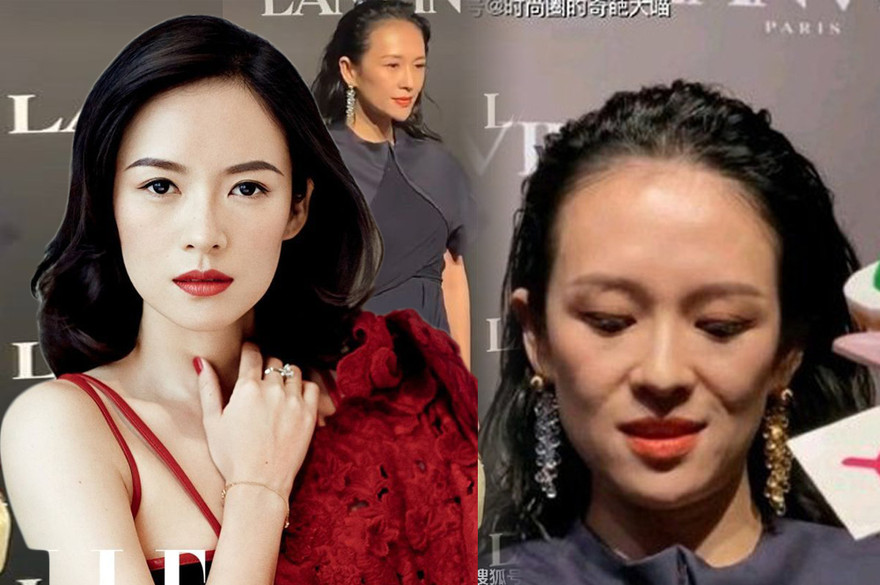 Nhan sắc Chương Tử Di xuống cấp thê thảm, lộ da chảy xệ, hói đầu sau sinh 