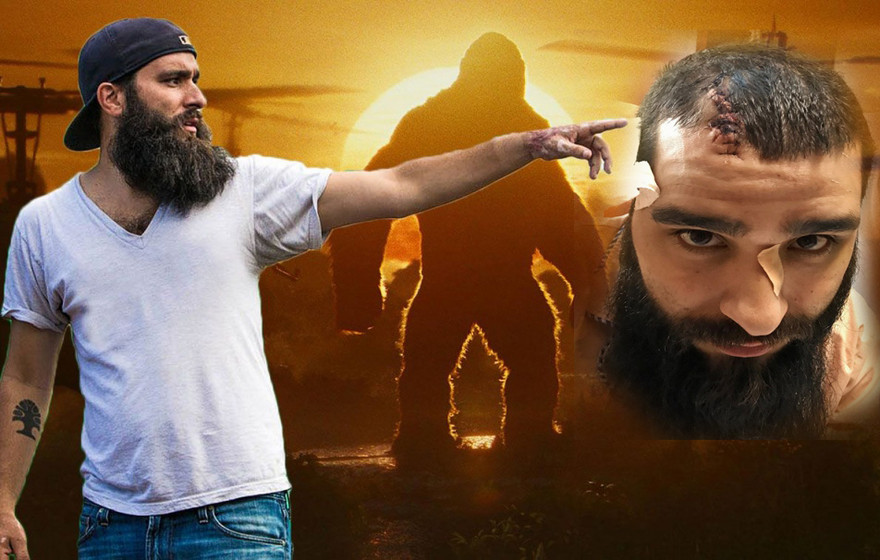 Toàn cảnh vụ đạo diễn phim Kong bị đánh vỡ hộp sọ ở Việt Nam gây sốc