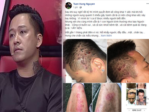 Showbiz 22/6: Tuấn Hưng suy sụp vì bị bệnh 'khó lòng chữa khỏi'