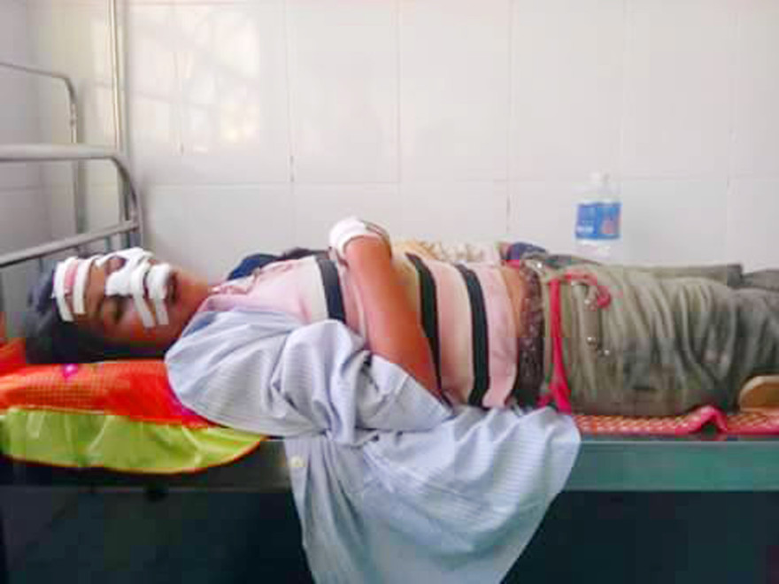 Nạn nhân tại Bệnh viện huyện Ia Pa.