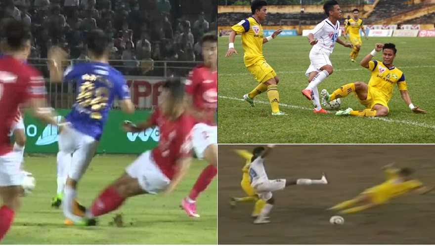 Những ca gãy chân kinh hoàng trong làng bóng đá Việt 