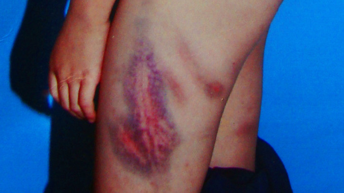 Bà Thảo đánh cháu Hùng Anh đến gãy roi tre ngày 2/4/2014. 