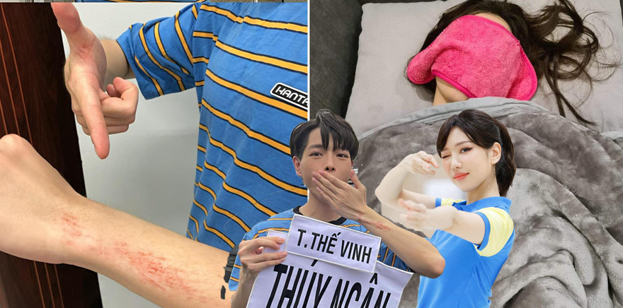 Dàn nghệ sĩ tiết lộ 'thương tích' sau khi tham gia Running Man