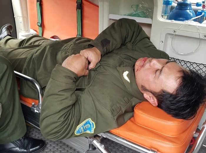 Trước đó, một nhân viên sân bay Nội Bài nhắc nhở các đối tượng "cò mồi" taxi hoạt động đã bị các đối tượng này hành hung gãy răng, rách môi 