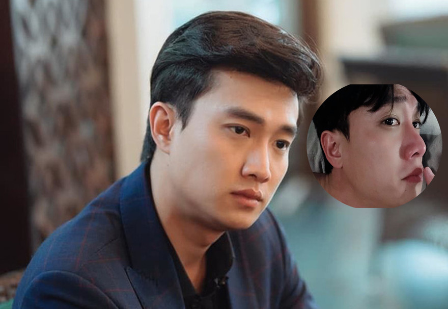 Quốc Trường - Vũ 'Về nhà đi con' lên tiếng về tin đồn phẫu thuật thẩm mĩ 