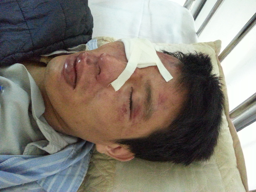 Nhân viên bán vé xe buýt bị hành hung dã man