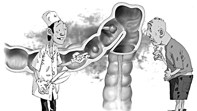 Viêm đại tràng - điều trị ngay khi có dấu hiệu