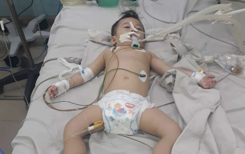 Bé 20 tháng tuổi nguy kịch tại trường không phải do cô giáo bạo hành
