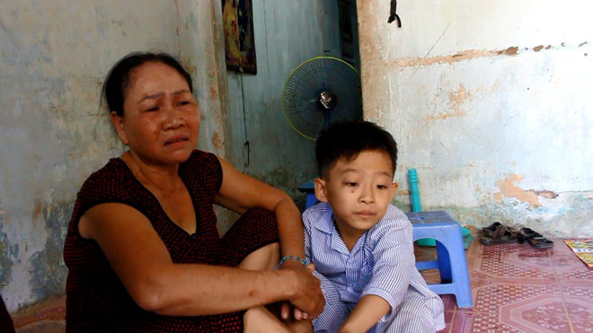 Bà Nam bức xúc vì cháu mình bị cô giáo đánh tím đùi