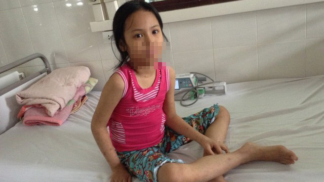  Bệnh nhi trước lúc ra viện. Ảnh: Sức Khỏe Đời Sống 