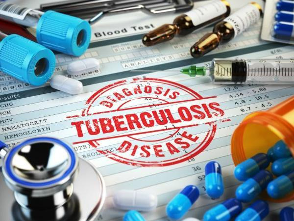 Điều trị bệnh lao bằng ứng dụng điện thoại cho thấy tín hiệu tích cực đối với bệnh nhân