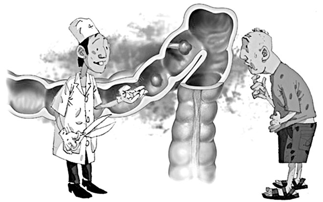 Viêm đại tràng - Điều trị ngay khi có dấu hiệu