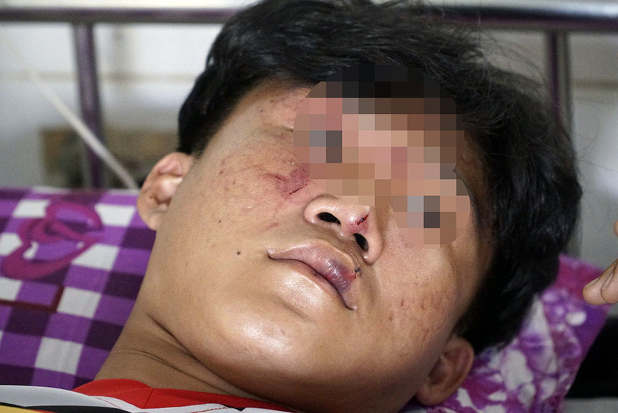 Em L.V.K là HS lớp 11 bị hành hung phải nằm viện điều trị. Ảnh: VietNamNet