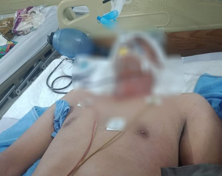 Anh Tấn tử vong do chấn thương sọ não.