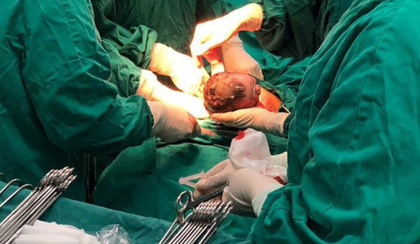 Bé Đàm Thị Phương Mai cất tiếng khóc chào đời lúc 0 giờ 3 phút ngày 1/1/2019 bằng phương pháp sinh mổ. (Nguồn: Bệnh viện Phụ sản Trung ương).