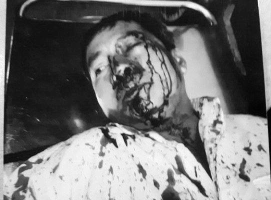  Ông Dũng bị nhóm côn đồ đánh nhập viện