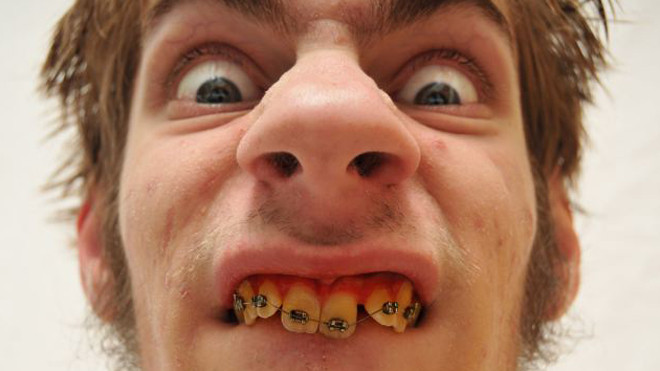 Vì sao phụ nữ thích cưới người xấu trai?