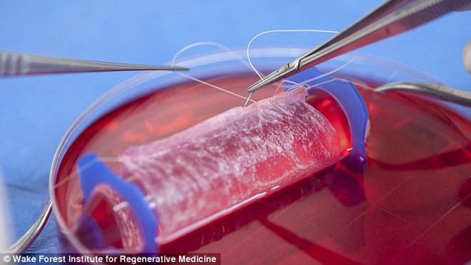 Âm đạo giả như thật