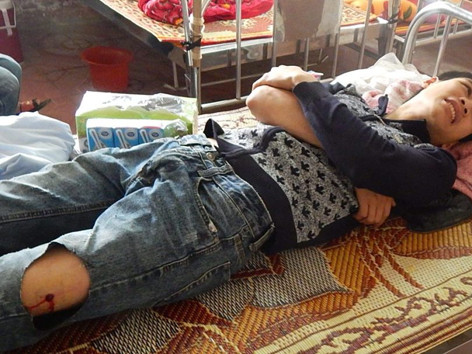 Lưu Văn Hương bị trúng đạn ở đầu gối khi cố tình cướp súng của lực lượng Kiểm lâm Ảnh: Hồng Quyền.