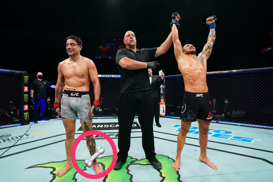 Gabriel Benitez (trái) chấp nhận thất bại trước Morales.