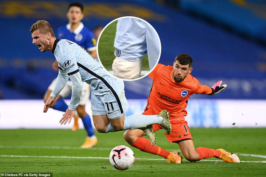 Timo Werner bị đau sau pha va chạm với Ryan ở giữa hiệp 1.