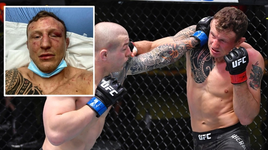 Chịu đòn đến phút cuối, võ sĩ UFC nhập viện khẩn cấp