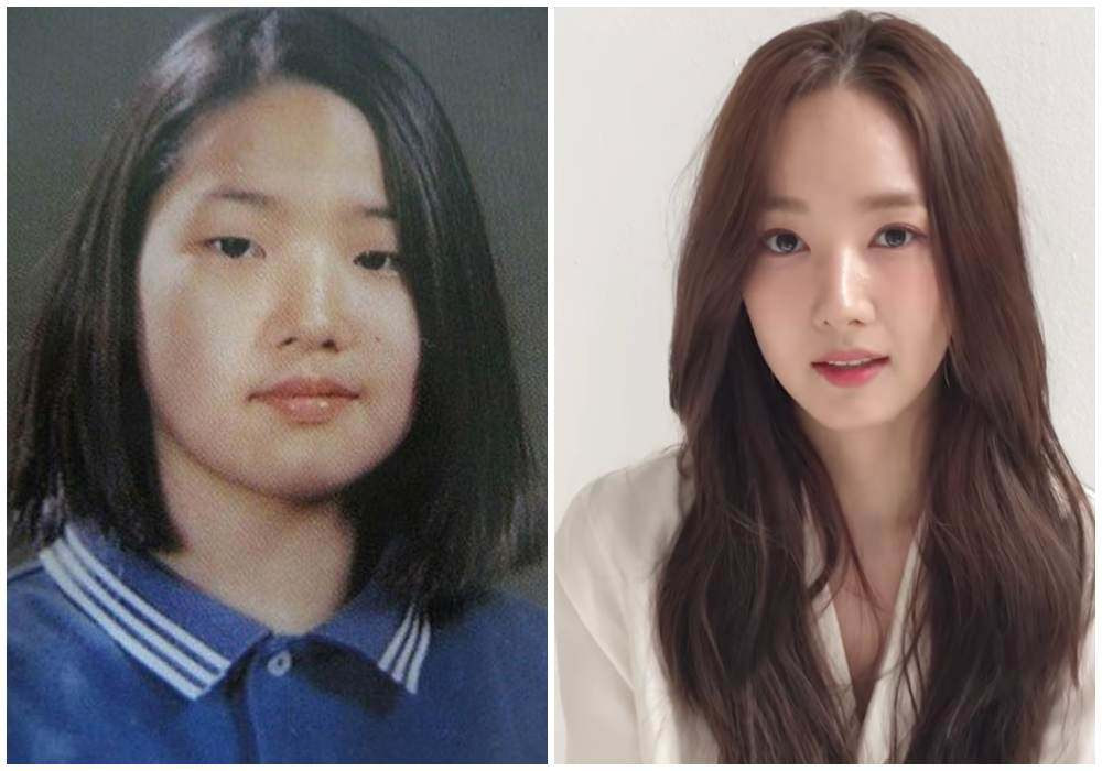 Park Min Young từng bị chê mũm mĩm, mặt không cân trước khi phẫu thuật thẩm mỹ.