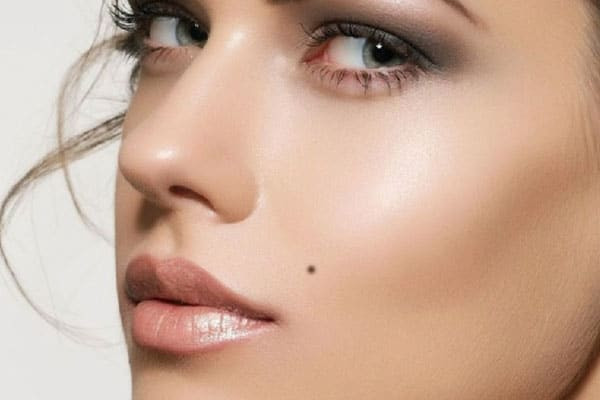 Nốt Ruồi Đỏ Ở Thái Dương