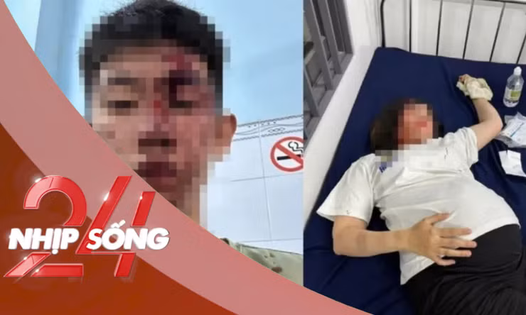 NHỊP SỐNG 24: Trẻ con tranh giành đồ chơi, thai phụ 8,5 tháng bị đánh dã man ở Đồng Nai