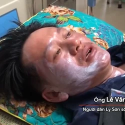 Ngư dân lao xuống biển cứu người ở đảo Lý Sơn: 'Tôi làm gì kịp suy nghĩ chuyện sống chết'