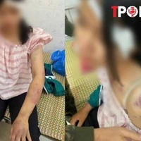 NÓNG 20/11: Bé gái bị gia đình nội tra tấn: Đây là hành vi nghiêm trọng
