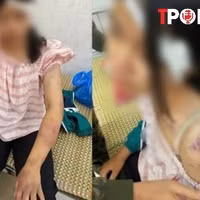 NÓNG 20/11: Bé gái bị gia đình nội tra tấn: Đây là hành vi nghiêm trọng