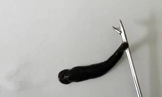 Gắp con đỉa dài 4cm sống trong mũi bé trai ở Quảng Trị