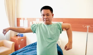 Công nghệ in 3D thay khớp, bù xương giúp bệnh nhân thoát cảnh khuỷu tay biến dạng hiếm gặp suốt 27 năm