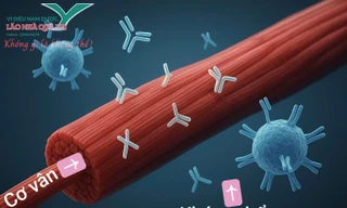 Kháng thể tự miễn tiêu cơ vân hướng phục hồi từ trị liệu khai thông cột sống