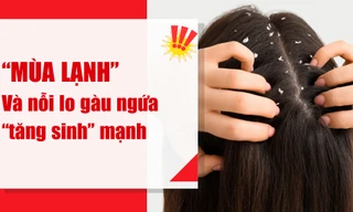 Chuyên gia lo ngại: Mùa lạnh bất thường 2025 làm gàu ngứa, viêm da đầu ‘tăng sinh’