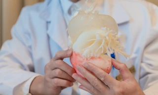 Ca thay van động mạch chủ qua da đầu tiên tại Việt Nam ứng dụng công nghệ in 3D cá thể hóa
