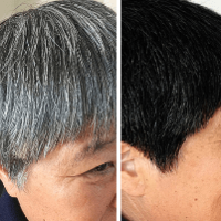Hết tóc bạc sau chỉ 1 khóa điều trị, không cần đến các liệu pháp đắt đỏ ở salon!