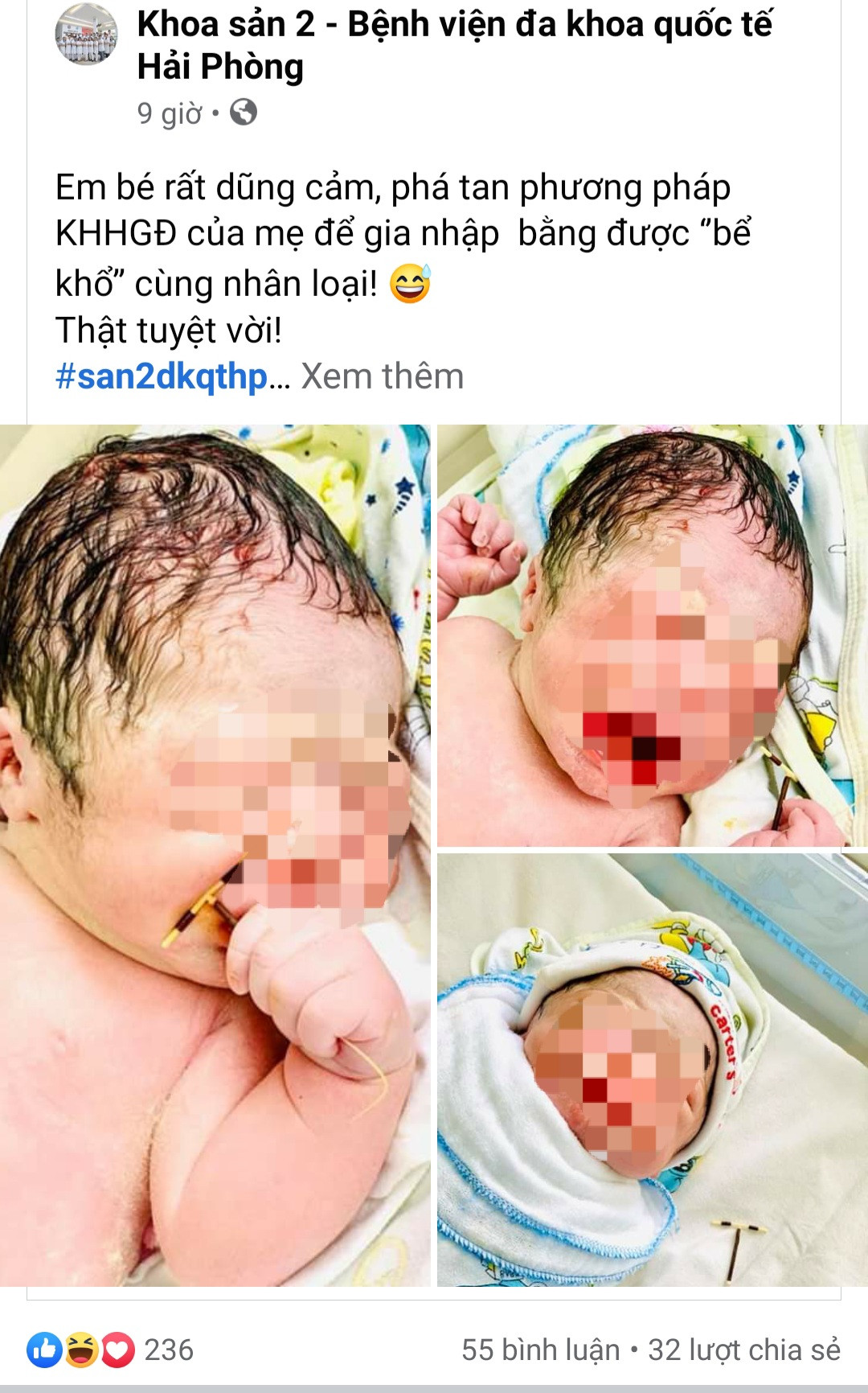 Hy hữu bé trai chào đời cùng vòng tránh thai của mẹ ảnh 1