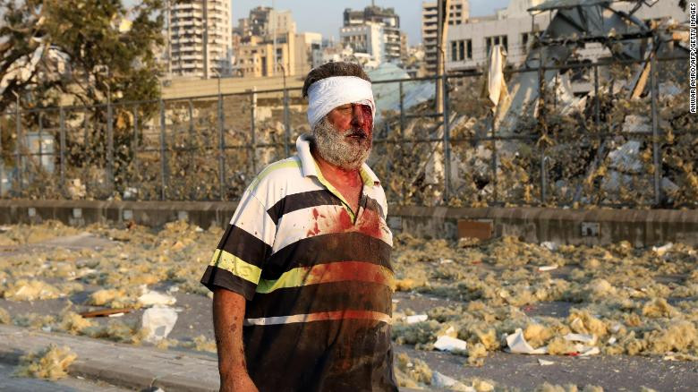 Ông Trump bị chỉ trích vì nói vụ nổ ở Li-băng là vụ tấn công ảnh 4