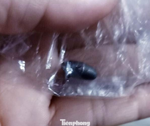 Phút sinh tử dân phòng đối mặt, dính ‘mưa đạn’ từ tên cướp xe ảnh 3